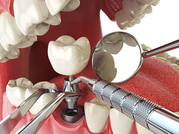 Best Broken or Cracked Tooth Emergency Dentist in Granger, WA