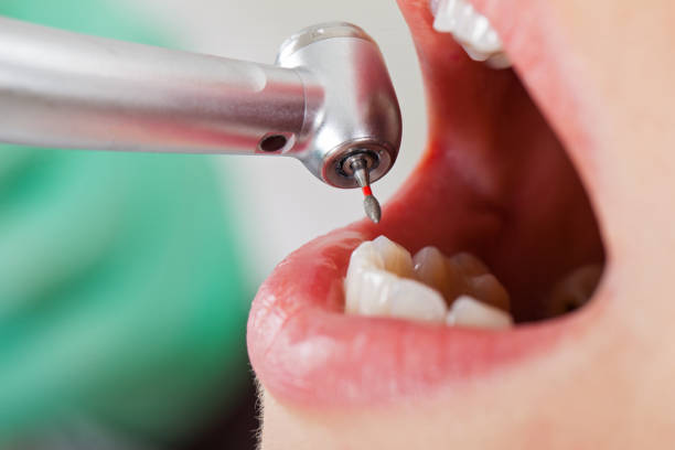 Best Mobile Emergency Dentist in Granger, WA